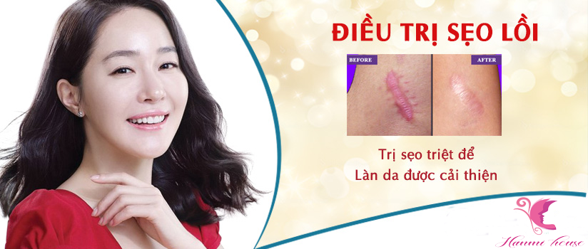 dieu-tri-seo-loi