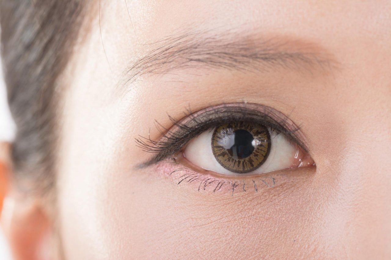 Kết quả sau phun mí mở tròng là mắt to tròn, khắc phục khuyết điểm của đôi mắt cũ